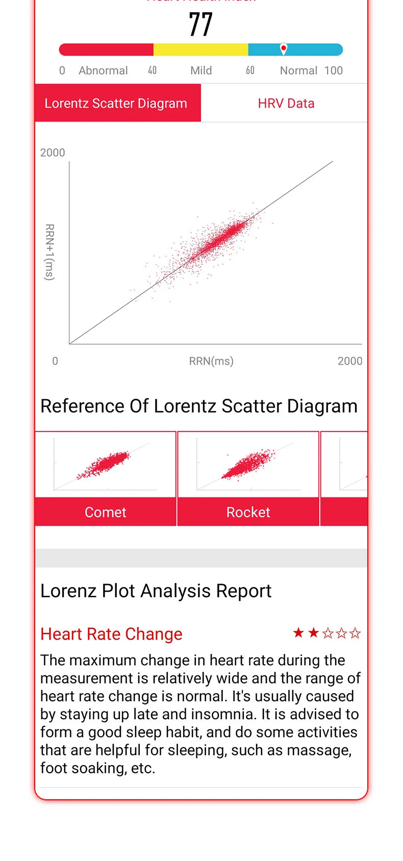 2025 New ECG+HRV Smart Watch Men Women Heart Rate Blood Pressure Body Temperature Sleep Monitor Fitness Pedometer Sports Watch